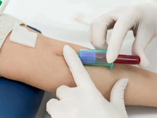 Как часто нужно сдавать общий анализ крови и что о вас скажут цифры