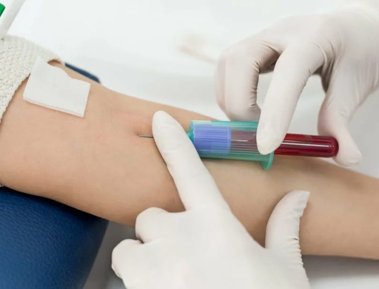 Как часто нужно сдавать общий анализ крови и что о вас скажут цифры