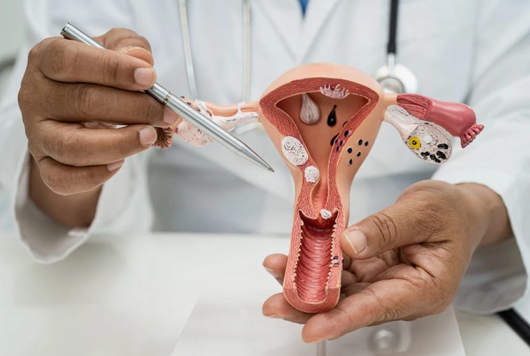 Биопсия влагалища при эрозии, дисплазии и ВПЧ — что важно знать