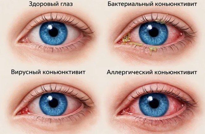 Детские болезни глаз: пять тревожных сигналов, которые взрослые чаще всего игнорируют