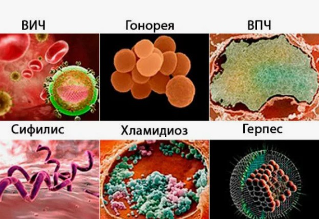 Скрытые угрозы: почему симптомы половых инфекций часто остаются незамеченными